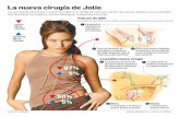 El ‘efecto Angelina’ se expande con extirpación de los ovarios