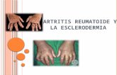 Artritis Reumatoide y la Esclerodermia.pptx