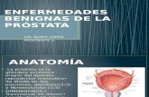 Enfermedades Benignas de La Próstata Clase