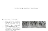 Lesiones dentales (radiografía)