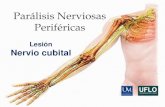 Lesiones de Nervios Periféricos Tp Tecnicas Kine