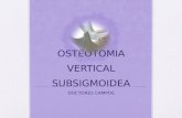 Osteotomia Vertical Subsigmoidea