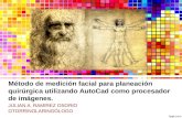 Método de medición facial para planeación quirúrgica utilizando AutoCad como procesador de imágenes. JULIAN A. RAMIREZ OSORIO OTORRINOLARINGÓLOGO.