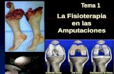 La Fisioterapia en las Amputaciones Tema 1. Equipo de salud del amputado Cirujano ortopédico y traumatológico Cirujano vascular Endocrinólogo Psiquiatra.