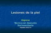 Lesiones de la piel Higiene Técnico en Atención Sociosanitaria Vegadeo 2012-13.