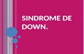 SINDROME DE DOWN.. ¿Qué es el síndrome de Down? El síndrome de Down es un trastorno cromosómico que incluye una combinación de defectos congénitos, entre.