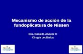 Mecanismo de acción de la fundoplicatura de Nissen Dra. Daniella Alvarez C Cirugía pediátrica.