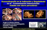 Ecocardiografía en la Indicación y Seguimiento de la Comunicación Interauricular tratada con cierre percutáneo Angel M Alonso Gómez Laboratorio de Ecocardiografía.