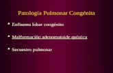 Patología Pulmonar Congénita  Enfisema lobar congénito  Malformación adenomatoide quística  Secuestro pulmonar.