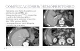 COMPLICACIONES: HEMOPERITONEO 1 Paciente con fallo hepático en contexto de LMMC en tratamiento con TPH, presenta cuadro de fallo hepático. Biopsia para.