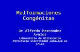 Malformaciones Congénitas Dr Alfredo Hernández Avalos Laboratorio de Ultrasonido Pontificia Universidad Católica de Chile.