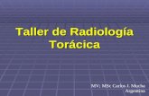Taller de Radiología Torácica MV; MSc Carlos J. Mucha Argentina.