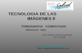 TECNOLOGIA DE LAS IMÁGENES ll TOMOGRAFIA COMPUTADA PEÑASCOS - OIDO Dra. María Cristina Gariboldi 16-10-2009 http:// . com Mail: dragariboldi@hotmail.com.