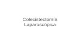 Colecistectomía Laparoscópica. Consiste en la ablación completa de la vesícula biliar Es la primera intervención convalidada en cirugía laparoscópica.