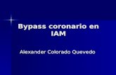 Bypass coronario en IAM Alexander Colorado Quevedo.