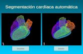 Segmentación cardíaca automática DiastoleSistole.