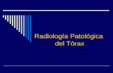 Radiolog­a Patol³gica del T³rax. Radiograf­a de T³rax Normal