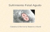 Sufrimiento Fetal Agudo Cátedra Enfermería Materno infantil.