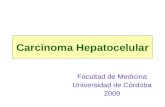 Carcinoma Hepatocelular Facultad de Medicina Universidad de Córdoba 2009.