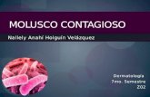 Nallely Anahí Holguín Velázquez MOLUSCO CONTAGIOSO Dermatología 7mo. Semestre Z02.