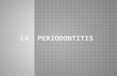 La periodontitis es una enfermedad inflamatoria de los tejidos periodontales que puede dar lugar a la pérdida gradual de los dientes y de las estructuras.