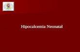 Hipocalcemia Neonatal. Hipocalcemia Definición Definición Nivel plasmático inferior a 7 mg/dl o niveles de calcio ionizado menor de 4mg/dl Nivel plasmático.