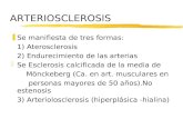 ARTERIOSCLEROSIS zSe manifiesta de tres formas: 1) Aterosclerosis 2) Endurecimiento de las arterias zSe Esclerosis calcificada de la media de Mönckeberg.