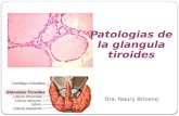 Patologias de la glangula tiroides Dra. Naury Briceno.