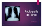 Radiografía de Tórax AGOSTO 2015 Dr. Luis M. Alcalá Valdés / nrr.