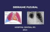 DERRAME PLEURAL HOSPITAL CENTRAL IPS 2015. LIQUIDO PLEURAL NORMAL El espacio pleural, situado entre la pleura parietal y la visceral está ocupado en el.