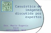 Casuística de imágenes discutida por expertos Dra. María Eugenia Dave SEPTIEMBRE 2015.