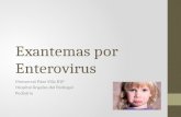 Exantemas por Enterovirus