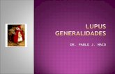 Lupus Generalidades