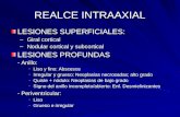 REALCE INTRAAXIAL