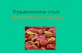 Trypanosoma cruzi (Enfermedad de Chagas)