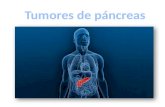 Tumores  de páncreas