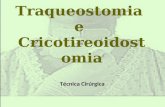 Traqueostomia  e  Cricotireoidostomia