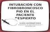 INTUBACIÓN CON FIBROBRONCOSCOPIO EN EL PACIENTE DESPIERTO