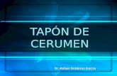 TAPÓN DE CERUMEN