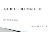 ARTRITIS REUMATOIDE DR. RAÚL ROJAS OCTUBRE 2012