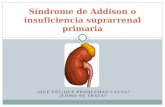 Síndrome de  Addison  o insuficiencia suprarrenal primaria