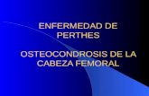 ENFERMEDAD DE PERTHES OSTEOCONDROSIS DE LA CABEZA FEMORAL
