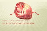 El Electrocardiograma