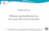 4.- Mejora periodontal en un caso de extracciones - Rafael Gallardo Galdón