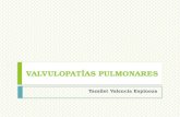 VALVULOPATIAS PULMONARES