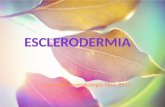 Esclerodermia juvenil
