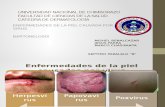 Dermatología Herpes Virus y Papiloma VIrus