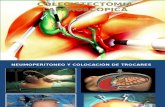 Colecistectomia Laparoscopica Laminas y Consejos