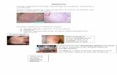 Dermatitis Atopica, Seborreica y Area de Pañal