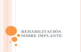 rehabilitación implantes ROMPE  2016.pdf